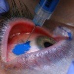 Prison Eye Ink: Eye Tattoos