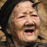 The Curious Case of the Cutaneous Horn Women