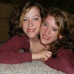 Top 10 Conjoined Twins