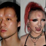 Bagel Heads - Saline Injections