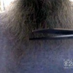 Amish Beard Attacks