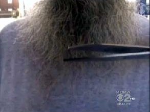 Amish Beard Attacks