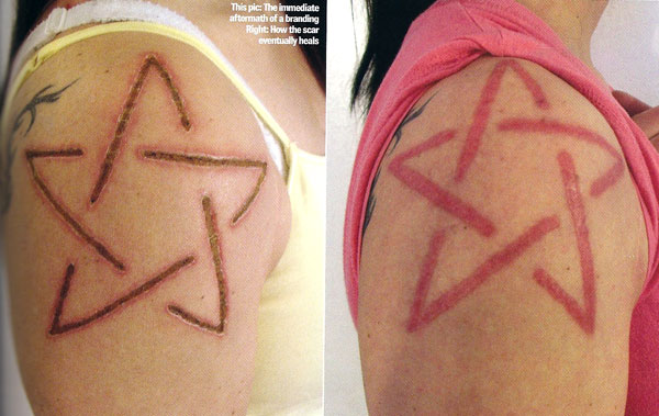 Branding Scarification