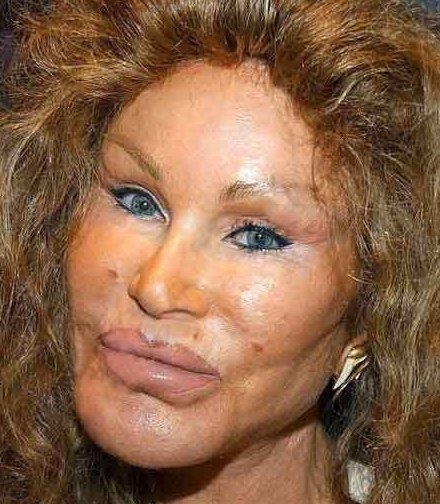 <em>Plastic Surgery Disasters... when will they stop?</em>