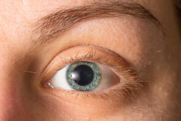 Can You Drive After Eye Dilation