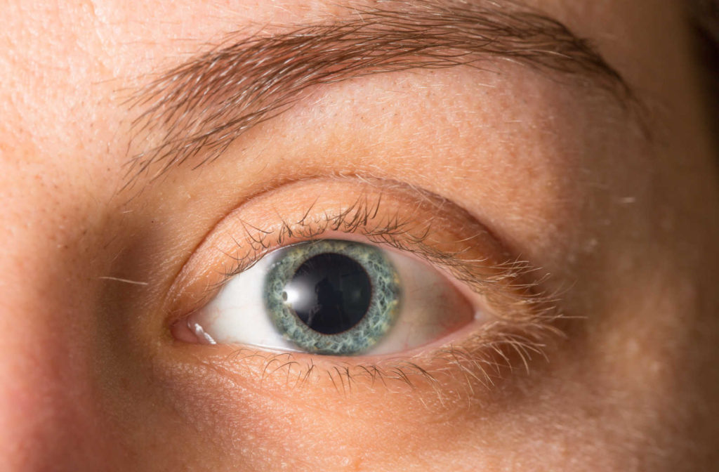 Can You Drive After Eye Dilation