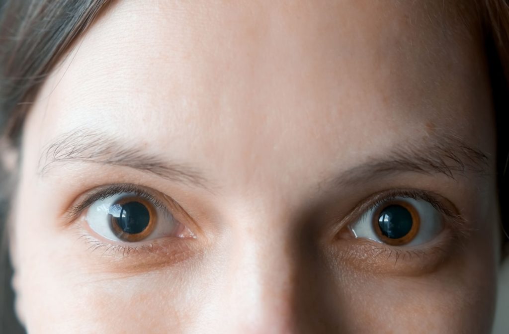 Can You Drive After Eye Dilation